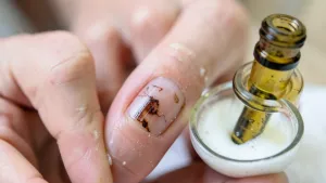 Czym odtłuścić płytkę paznokcia domowe sposoby