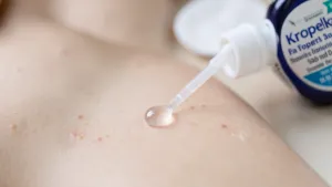 Czym zmyć klej kropelka z rąk