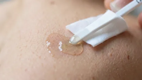 Jak usunąć klej do tipsów ze skóry