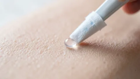 Jak usunąć klej kropelka ze skóry