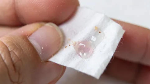 Jak zmyć klej do paznokci z palców