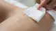 Jak usunąć klej po plastrach ze skóry